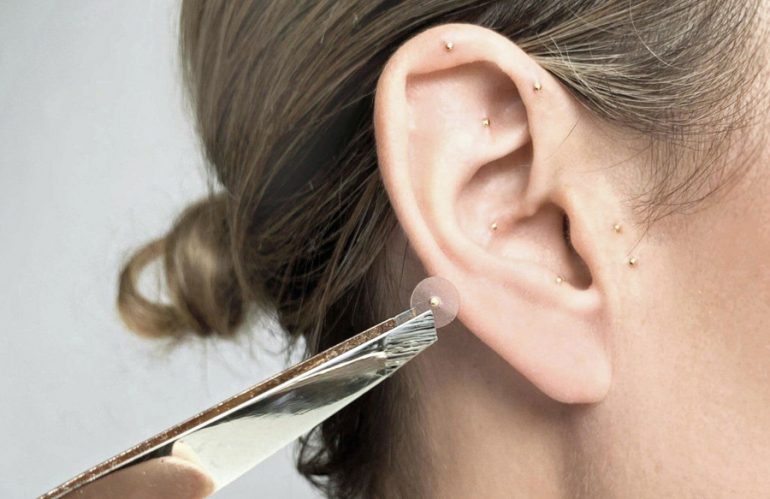 What are Ear Seeds?