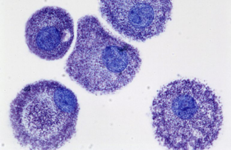 Mast Cell Activation Syndrome