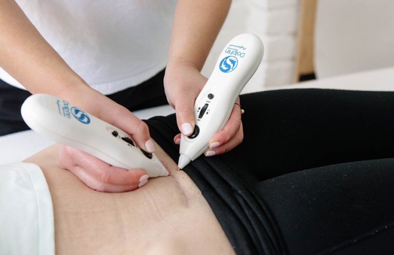 Microcurrent Point Stimulation