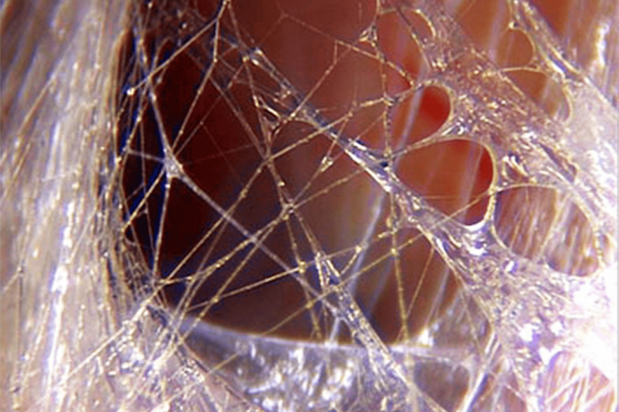 Fascia image