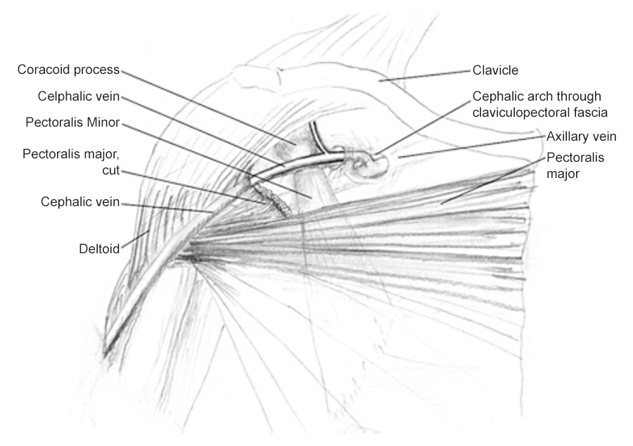 POST Lymph Pathways1