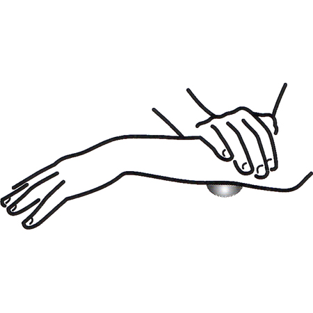 MELT HAND Shear Forearm Palmar