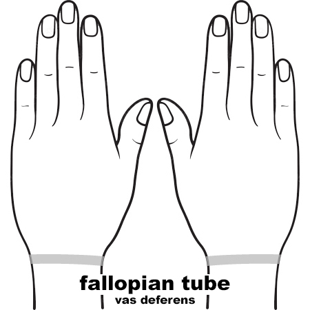 REFLEX Fallopian11
